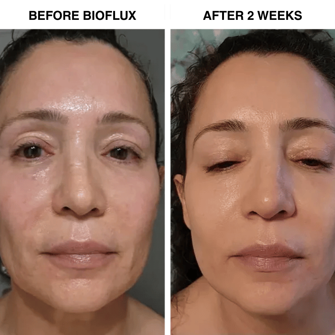 BioFlux Marine Spicule System