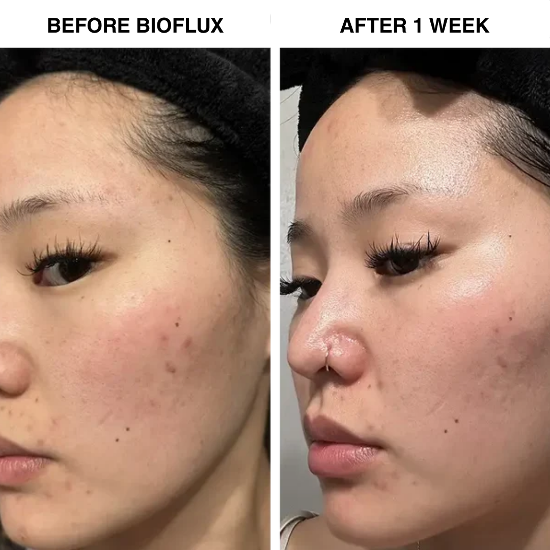 BioFlux Marine Spicule System